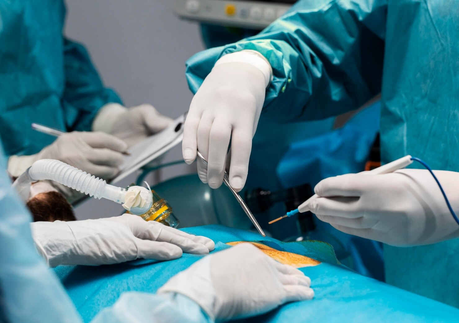 General Surgery